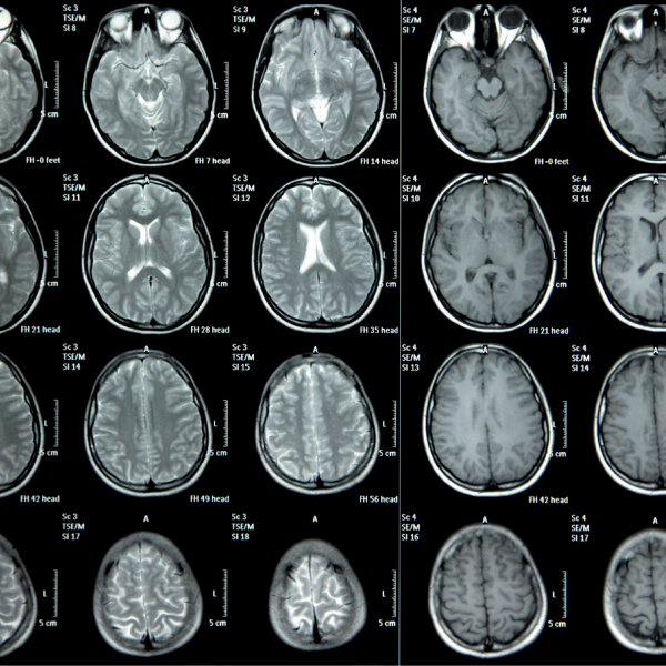 brain-mapping-xray